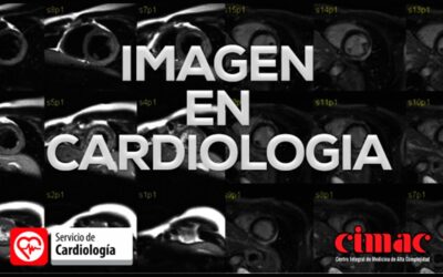 Imágenes en Cardiología