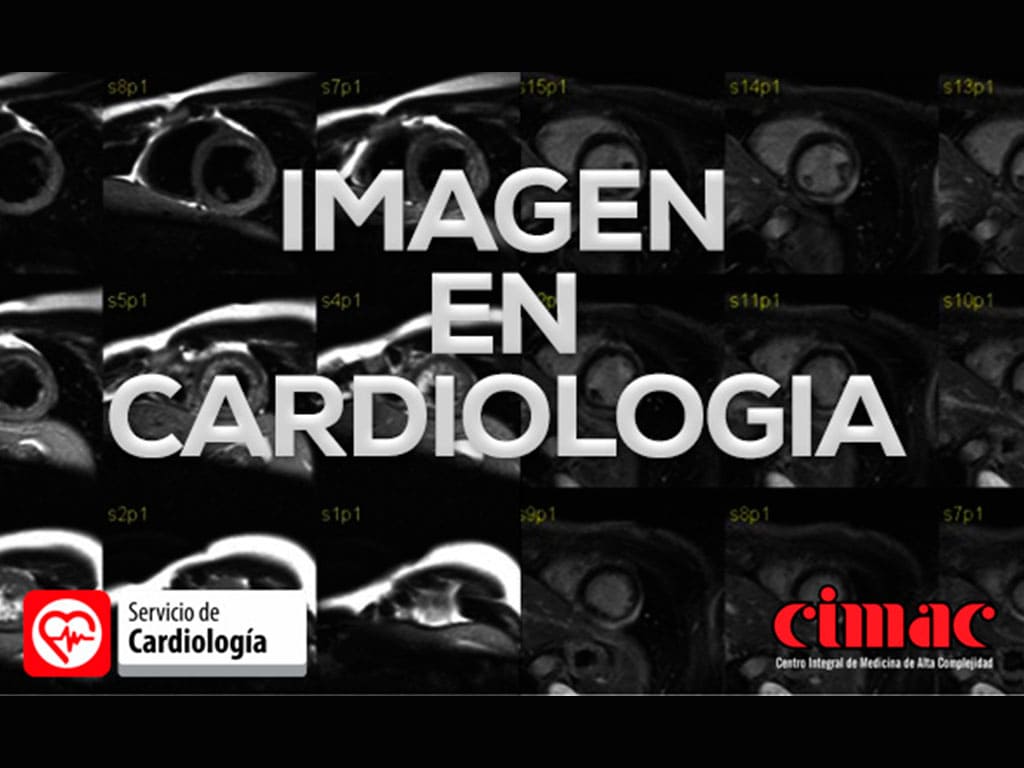 Imágenes-en-Cardiología