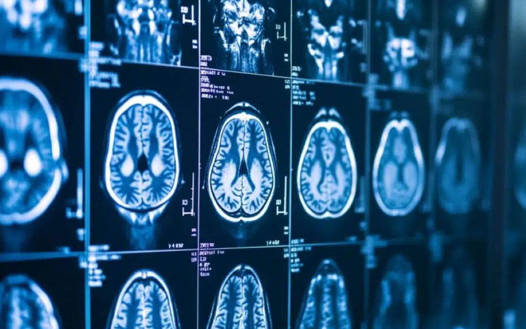 Orden de mérito 2025 para Ingreso a Residencia en Diagnóstico por Imágenes