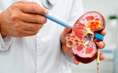 La Enfermedad Renal Crónica fue incorporada al Sistema Nacional de Vigilancia de la Salud